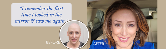Losing Your Hair: The Emotional Journey and Why Choosing a Wig Can Be Empowering